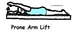 Prone arm lift